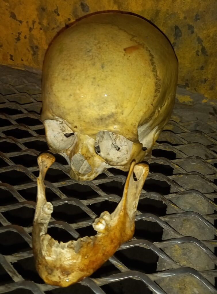 Recogían la basura y encontraron un cráneo y huesos humanos