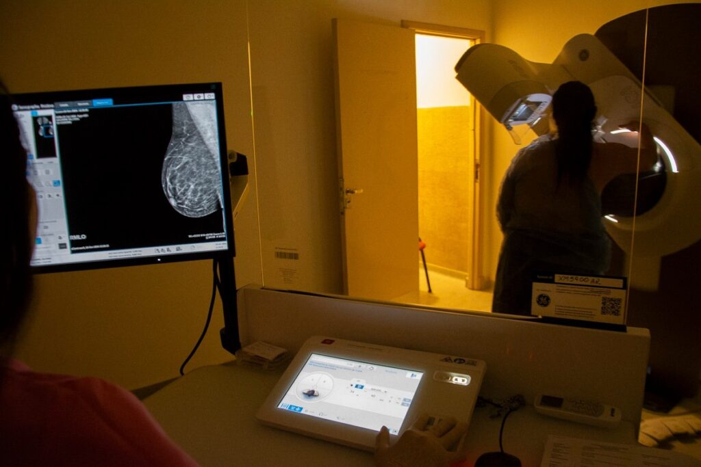 Casi 500 Mujeres accedieron a controles de mama gratuitos en el HIGA
