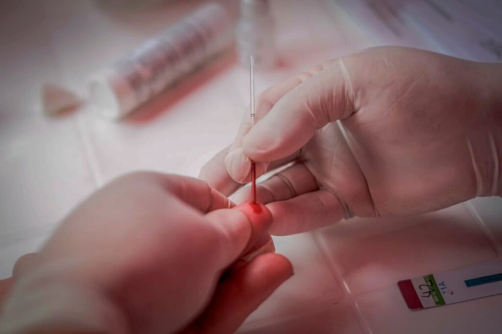 Realizarán testeos rápidos y gratuitos de VIH, Hepatitis C y Sífilis en distintos puntos de Mar del Plata